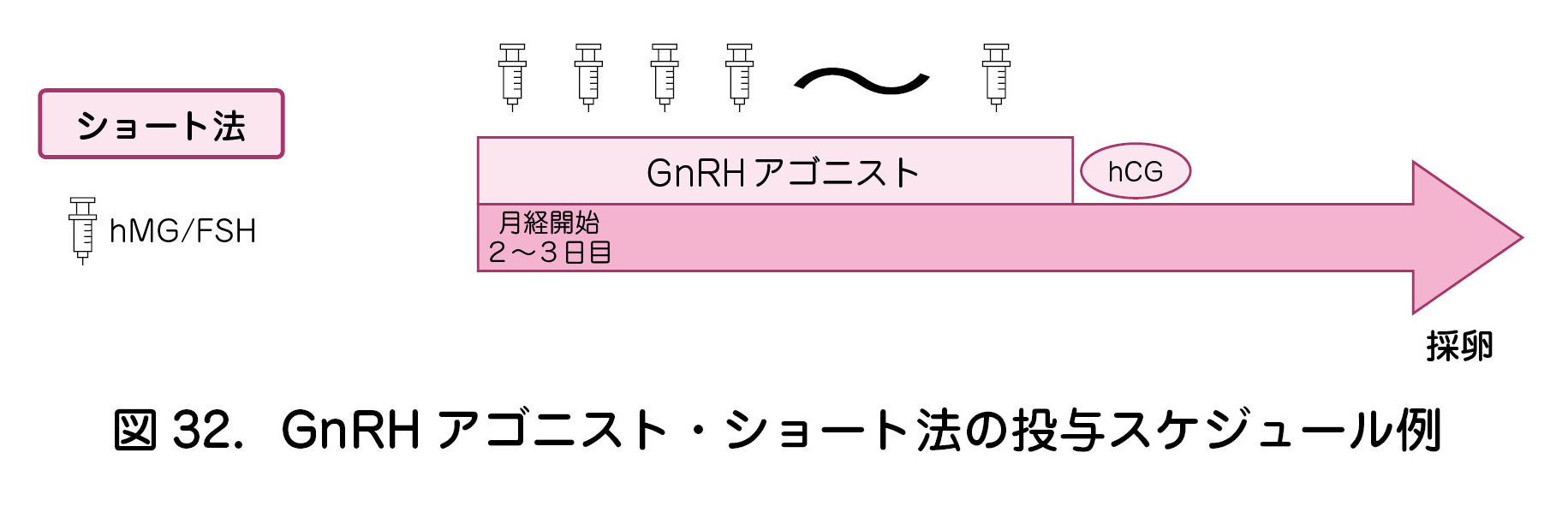 図32．GnRH アゴニスト・ショート法の投与スケジュール例