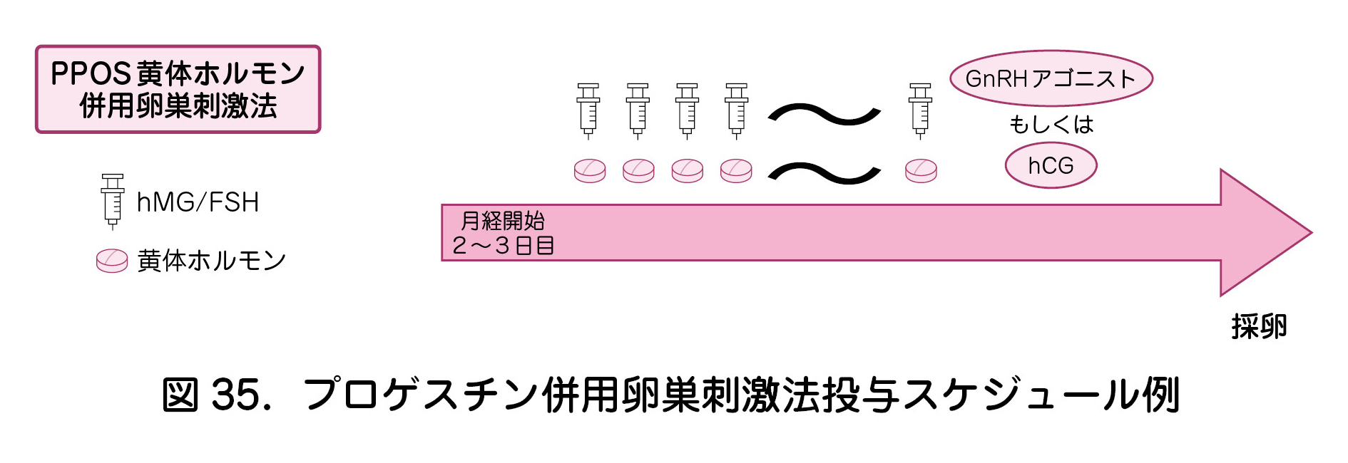 図35．プロゲスチン併用卵巣刺激法投与スケジュール例