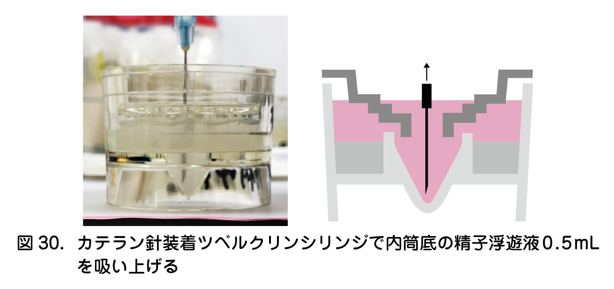 図30．カテラン針装着ツベルクリンシリンジで内筒底の精子浮遊液0.5mLを吸い上げる