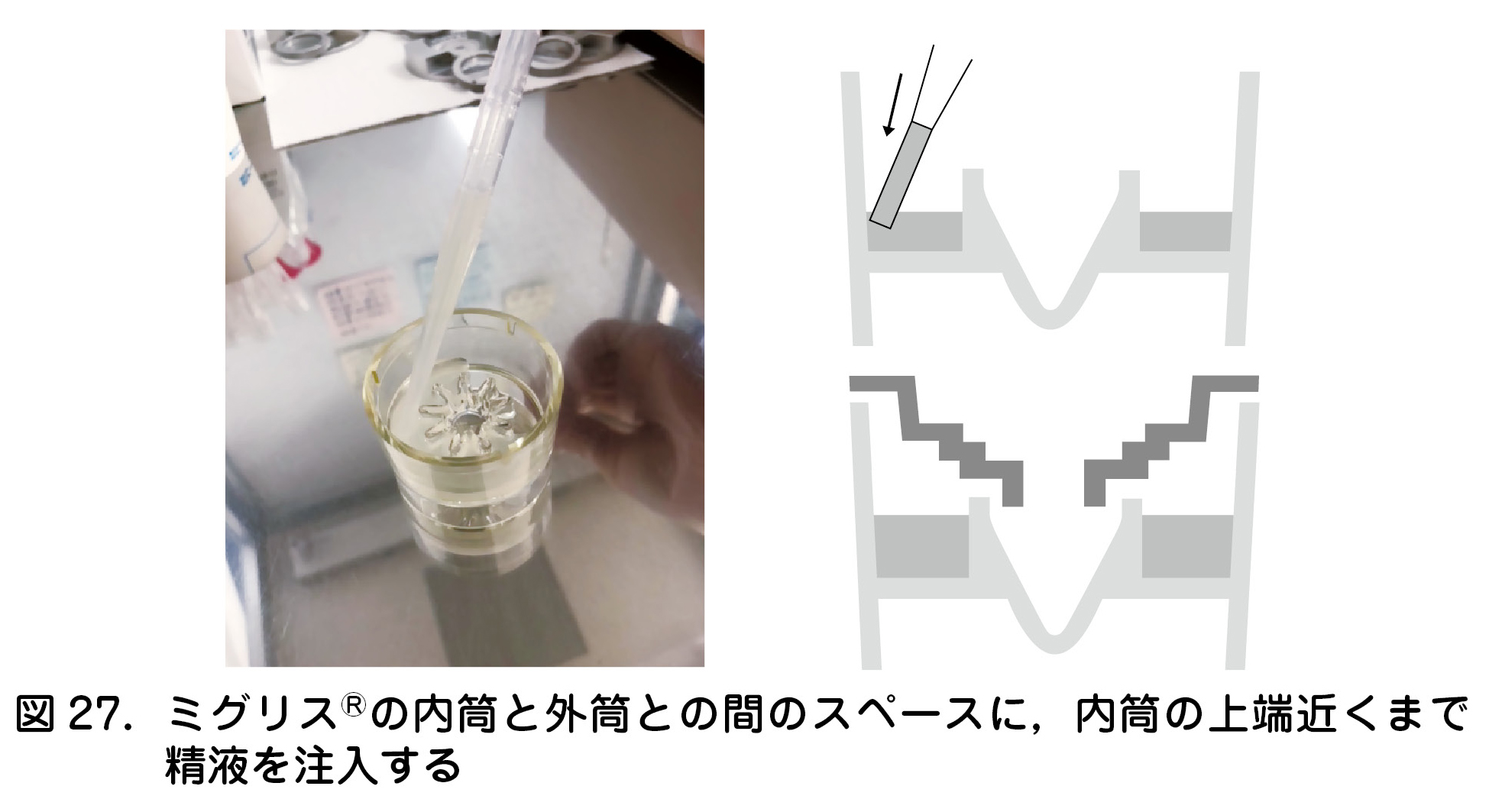 図27．ミグリス®の内筒と外筒との間のスペースに，内筒の上端近くまで精液を注入する